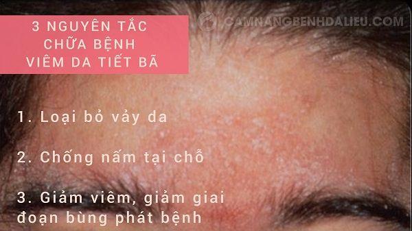 Các bệnh lí về da