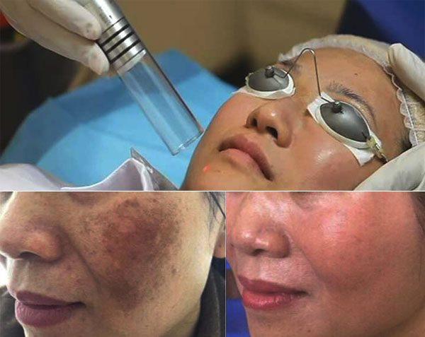 Phòng Khám chuyên khoa da liễu - BS CKll. Phạm Ngọc Cường
