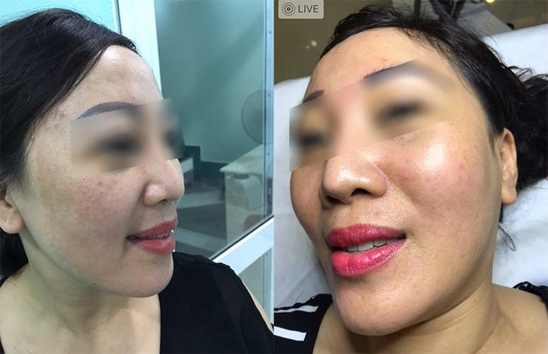 Phòng Khám chuyên khoa da liễu - BS CKll. Phạm Ngọc Cường