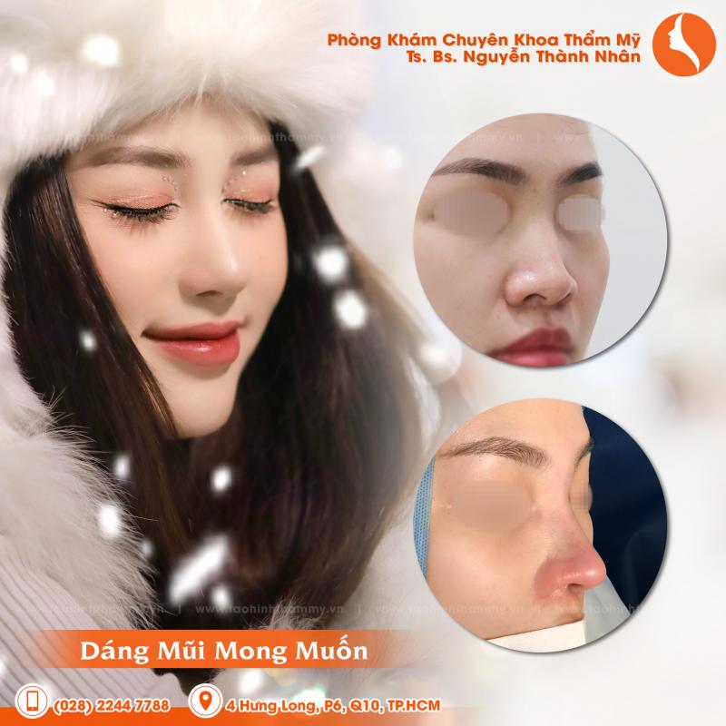 Phòng khám chuyên khoa Phẫu thuật thẩm mỹ TS. BS Nguyễn Thành Nhân