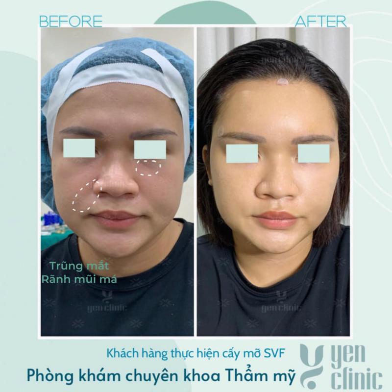 Phòng khám chuyên khoa Thẩm mỹ Yen Clinic