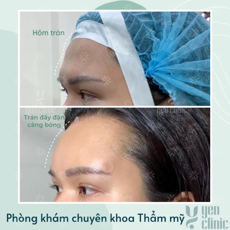 Phòng khám chuyên khoa Thẩm mỹ Yen Clinic