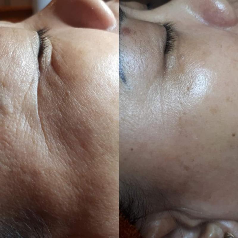 Phòng Khám Da Liễu 11 Hải Thượng Lãn Ông