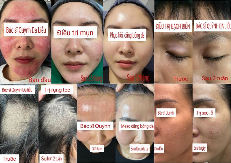 Phòng khám da liễu Bác sĩ Quỳnh