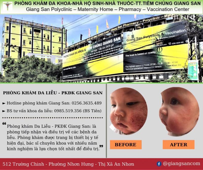 Phòng Khám Da Liễu Giang San