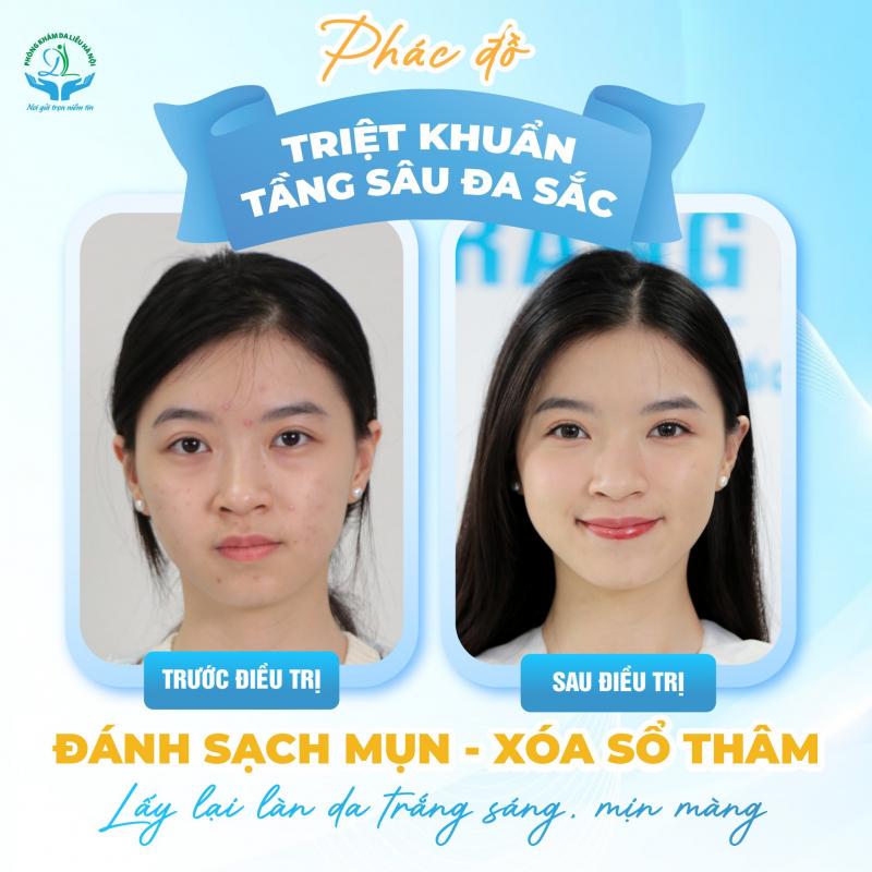 Phòng khám Da liễu Hà Nội