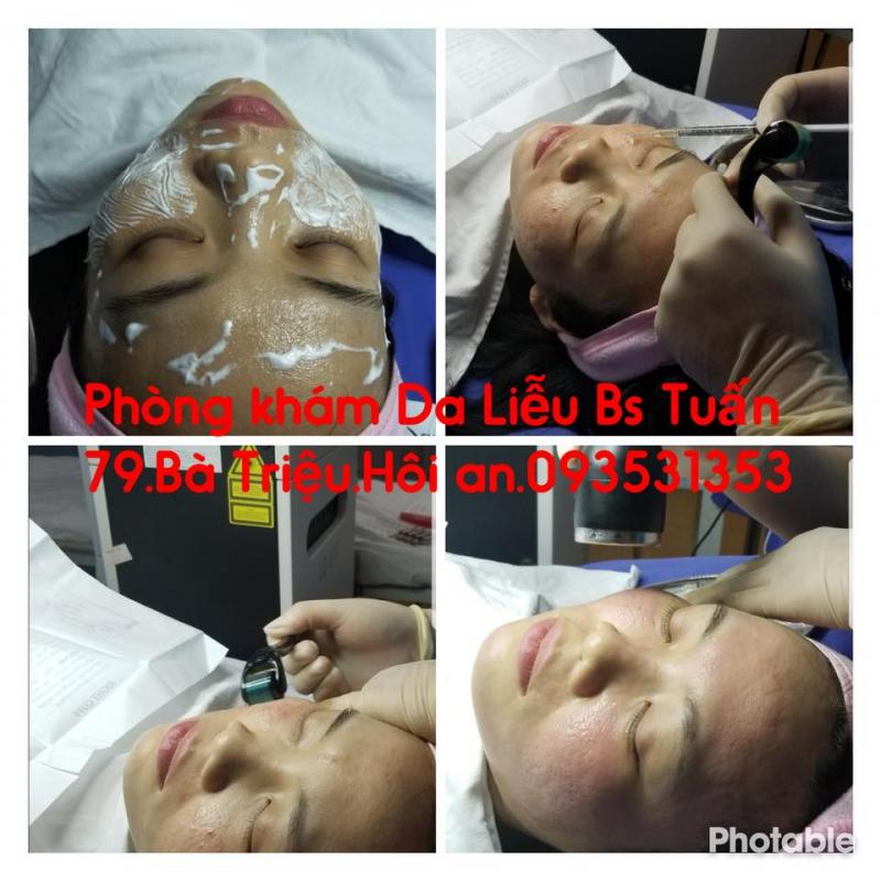 Phòng Khám Da Liễu - Laser Thẩm Mỹ Bs Hồ Tuấn