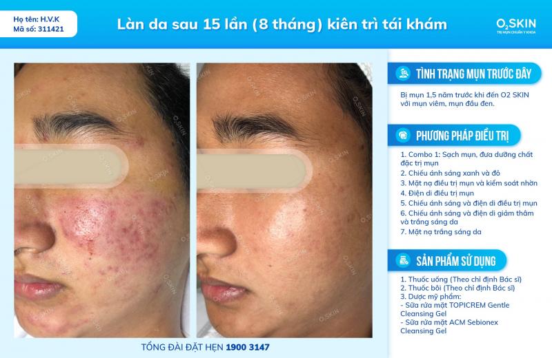 Phòng khám Da Liễu O2 SKIN