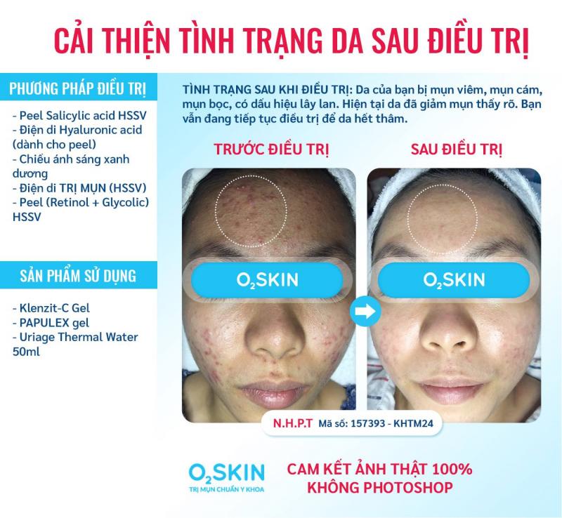 Phòng khám Da liễu O2 SKIN