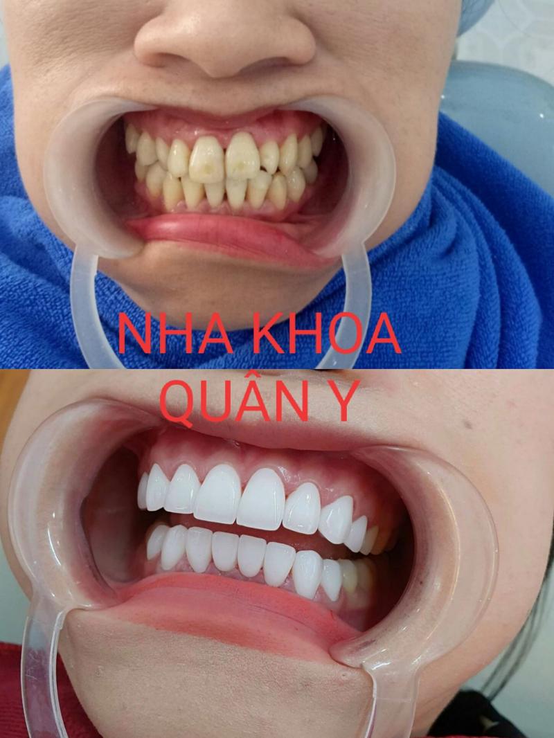 Phòng Khám Nha Khoa Quân Y