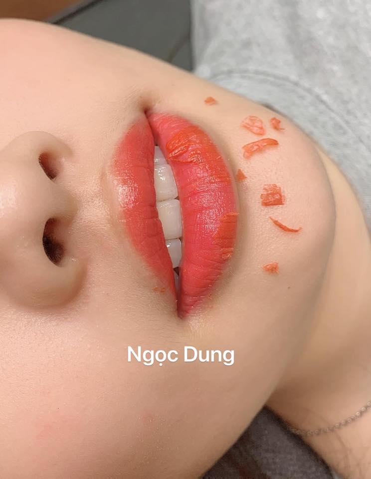 Môi bong không đau rát