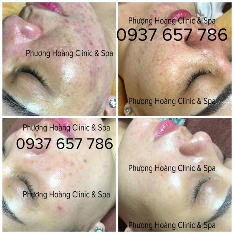 Phượng Hoàng Đà Lạt Clinic & Spa