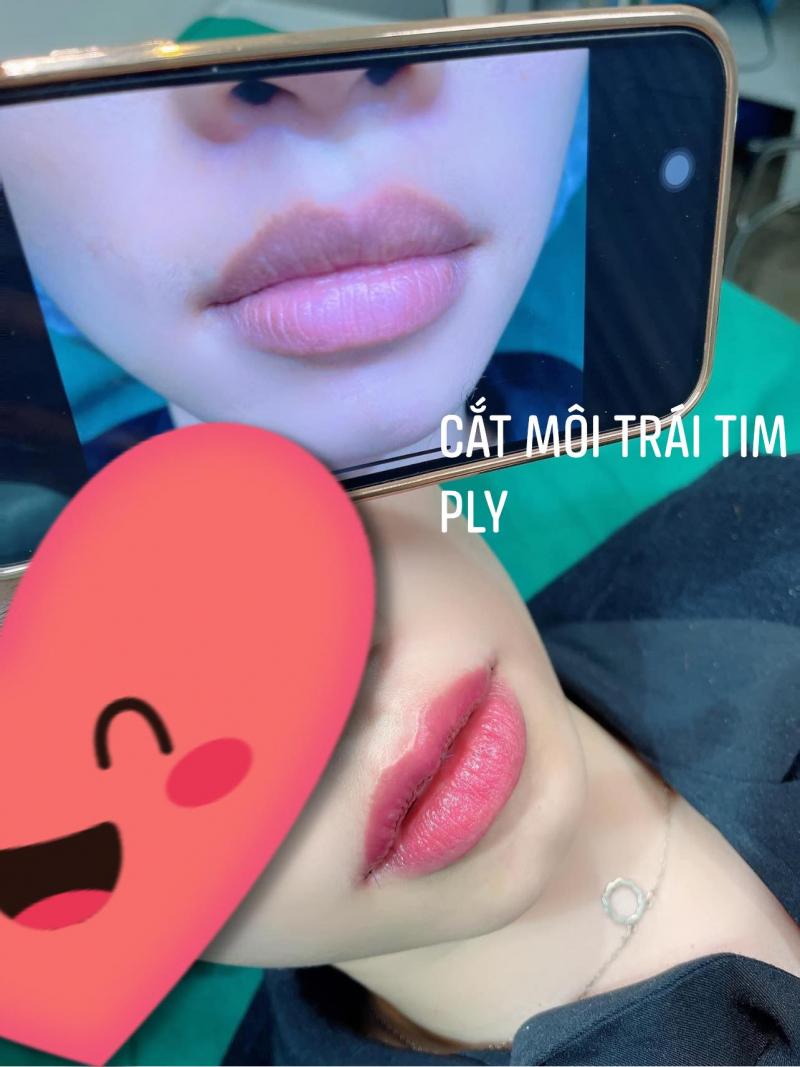 Phương Ly Spa