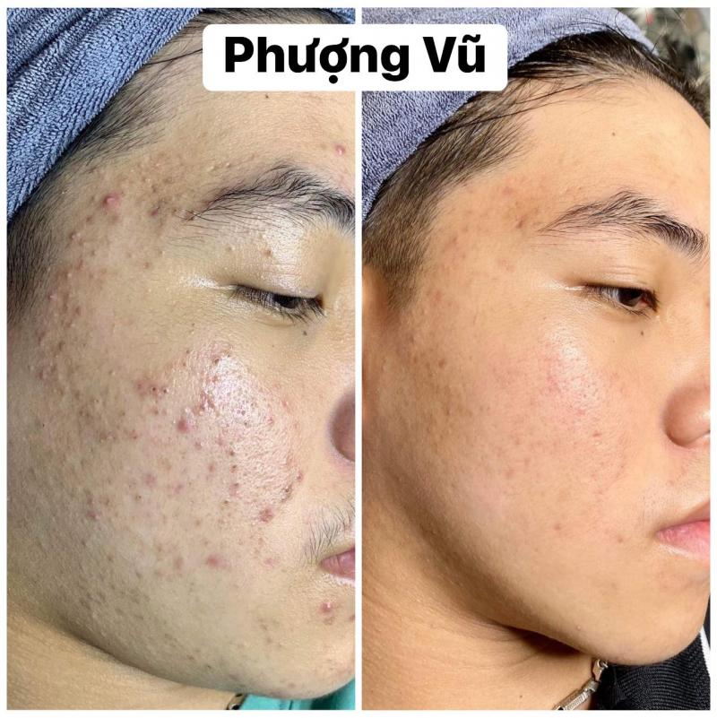 Phượng Spa