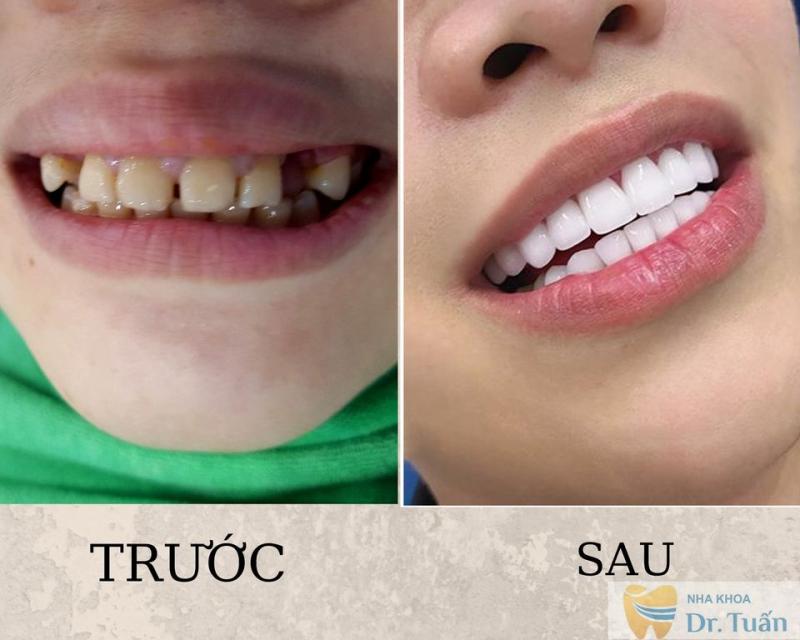 PK Nha Khoa BS Tuấn Nhà Thờ