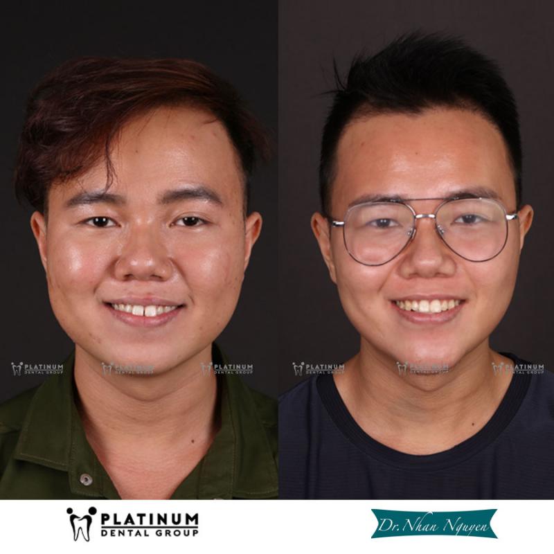 Platinum Dental Group