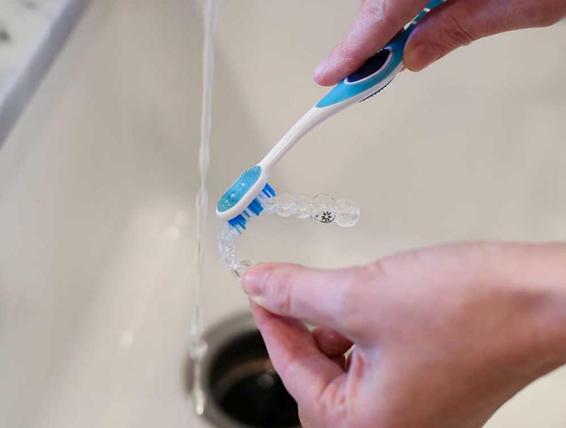 Làm thế nào để chăm sóc và làm sạch các ố vàng trên nẹp niềng răng Invisalign?