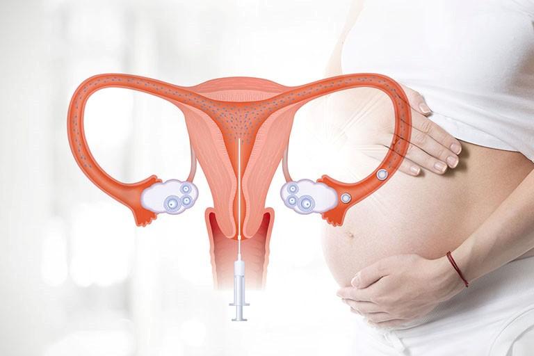 Quá trình sau khi thực hiện thụ tinh nhân tạo