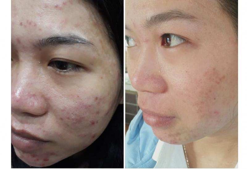 Queen spa Lai Thieu