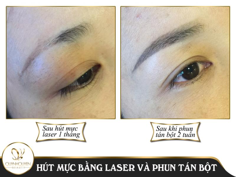 QuynhQuyen Beauty Center