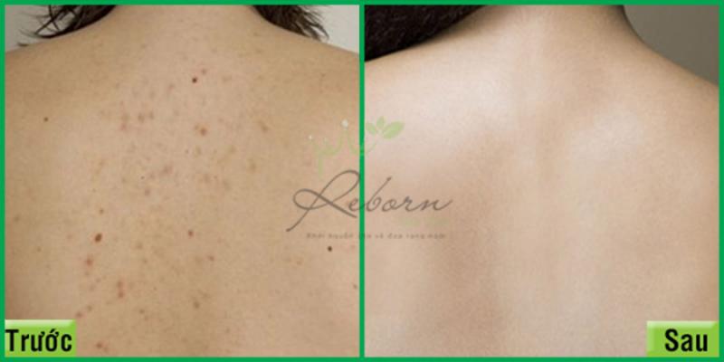 Reborn Skin Clinic