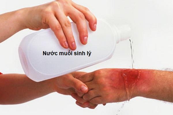 Nước muối có tác dụng sát khuẩn rất tốt