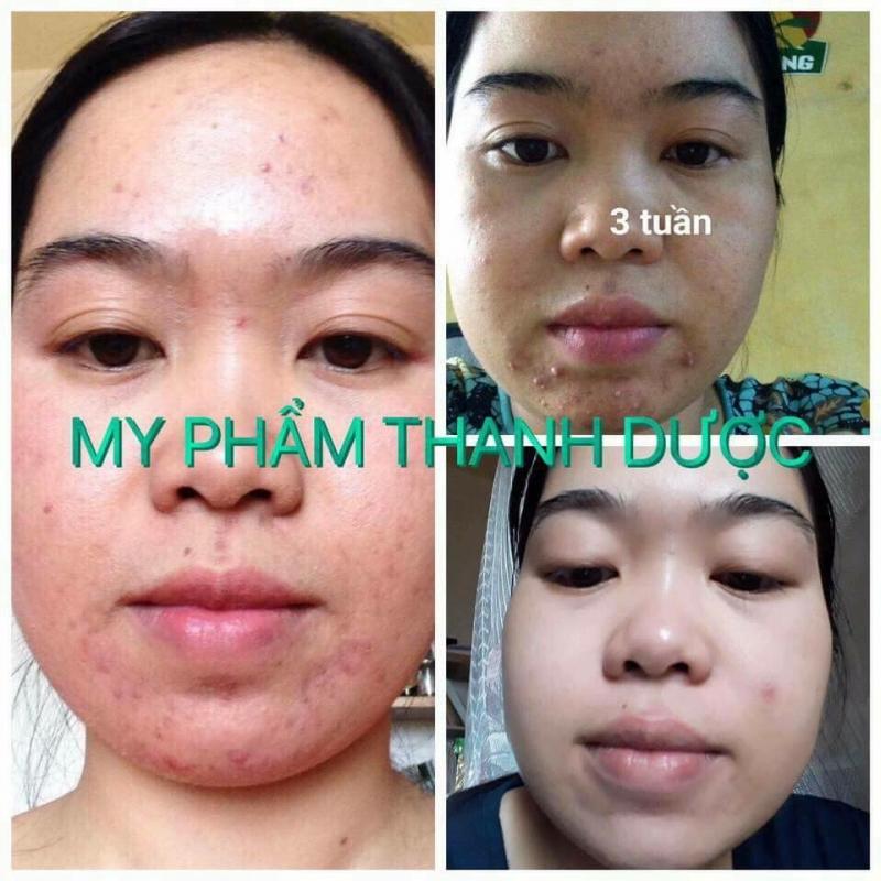 Khách hàng tin dùng Thanh Dược