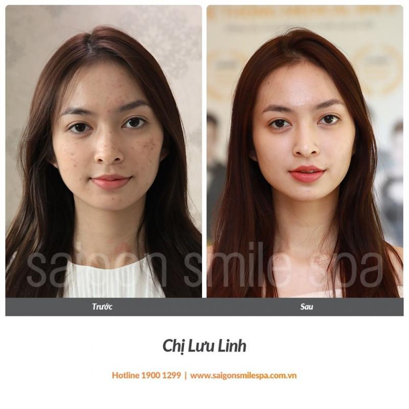 Saigon Smile Spa