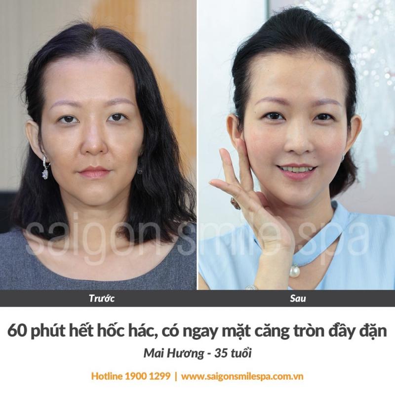Saigon Smile Spa