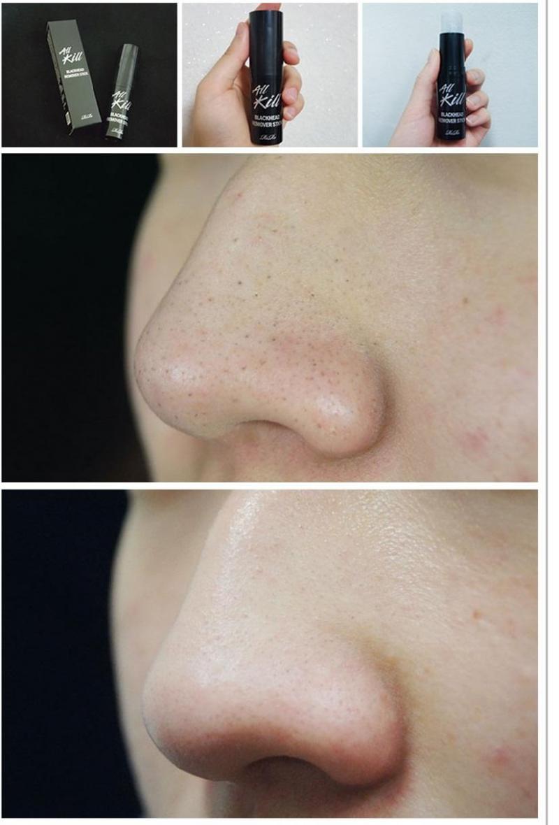 Sáp trị mụn đầu đen RiRe All Kill Blackhead Remover Stick cho thấy khả năng loại bỏ mụn đầu đen, mụn cám, mụn đầu trắng, bã nhờn, dầu thừa, tế bào chết trên da một cách hiệu quả