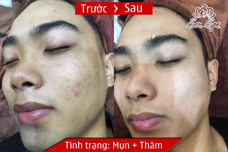 Sen Spa Thái Nguyên
