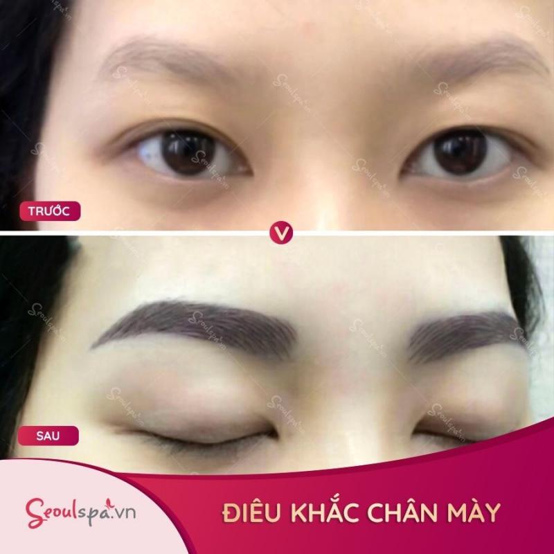 Thẩm Mỹ Viện SeoulSpa.Vn
