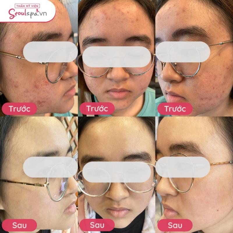 Thẩm Mỹ Viện SeoulSpa.Vn Phú Yên
