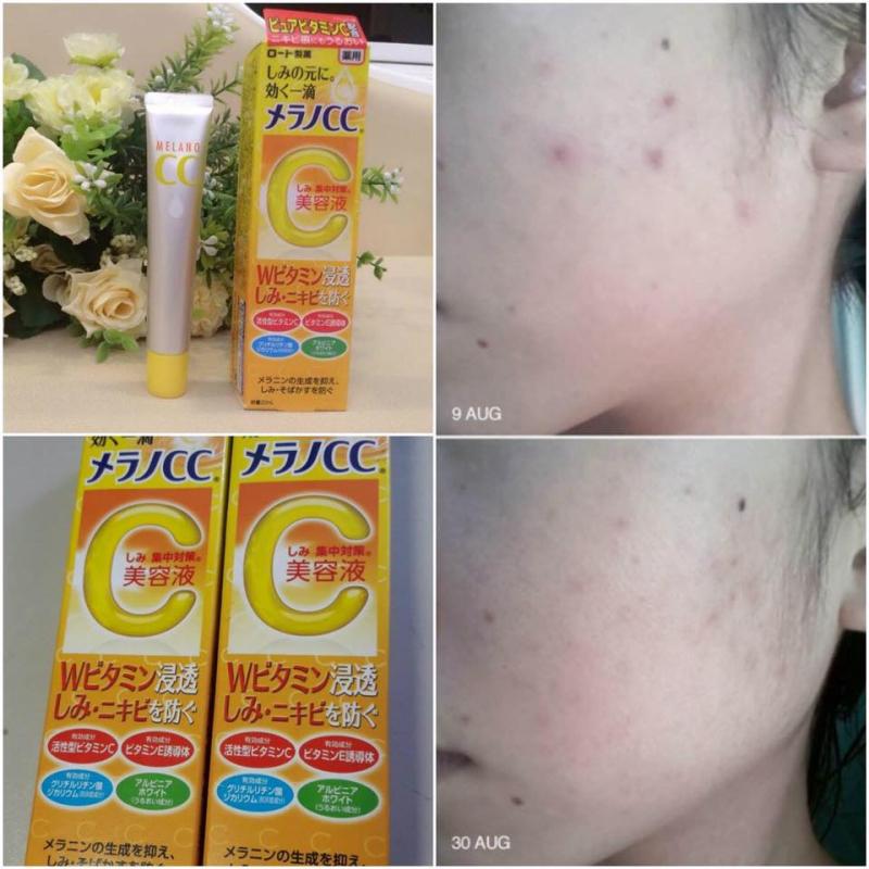 ﻿  Thành phần của Serum CC Melano gồm có: Ascorbic acid (vitamin C tinh khiết) có tác dụng giảm lượng melanin gây ra vấn đề thâm, nám, tàn nhang cho da, đồng thời làm sáng da và ngăn ngừa mụn xuất hiện lại