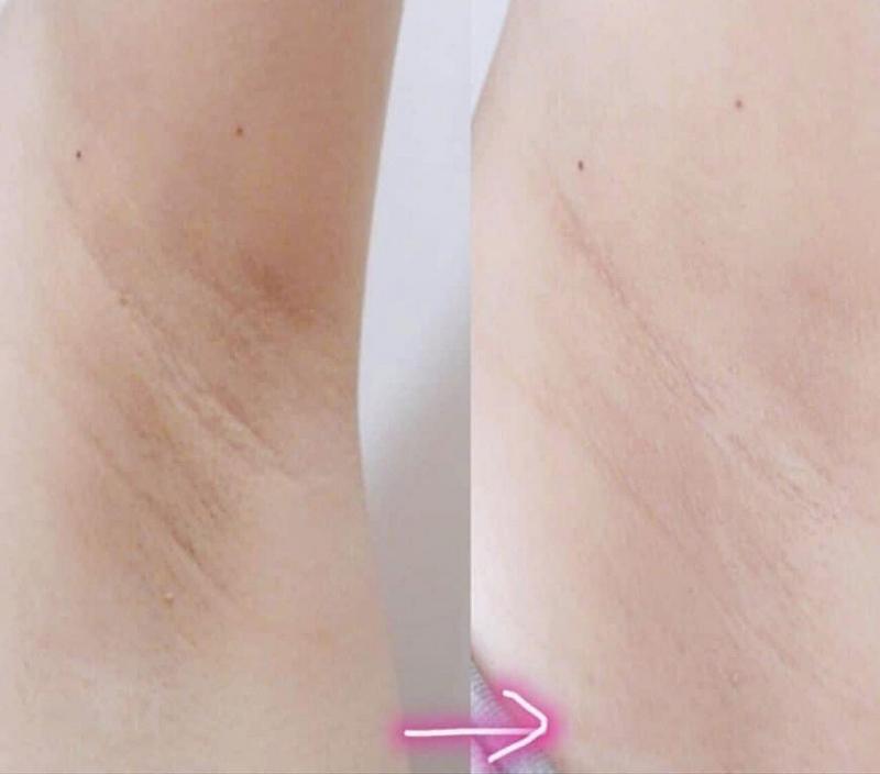 Serum khử mùi hôi nách SEIMY