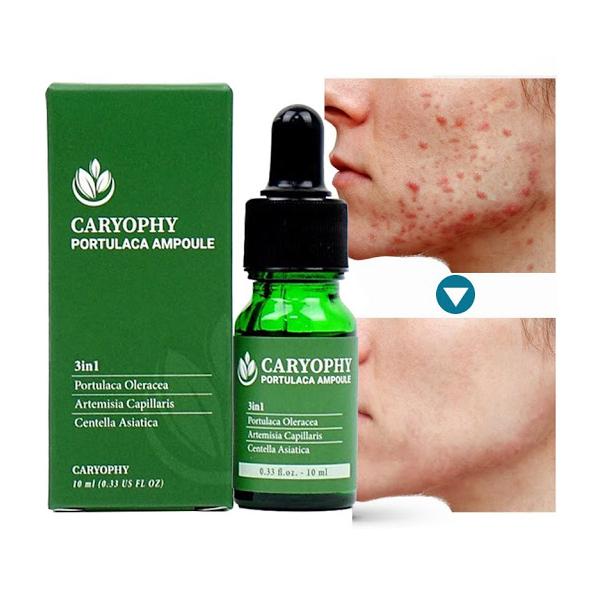 Serum rau má giảm mụn mờ thâm Caryophy Portulaca Ampoule