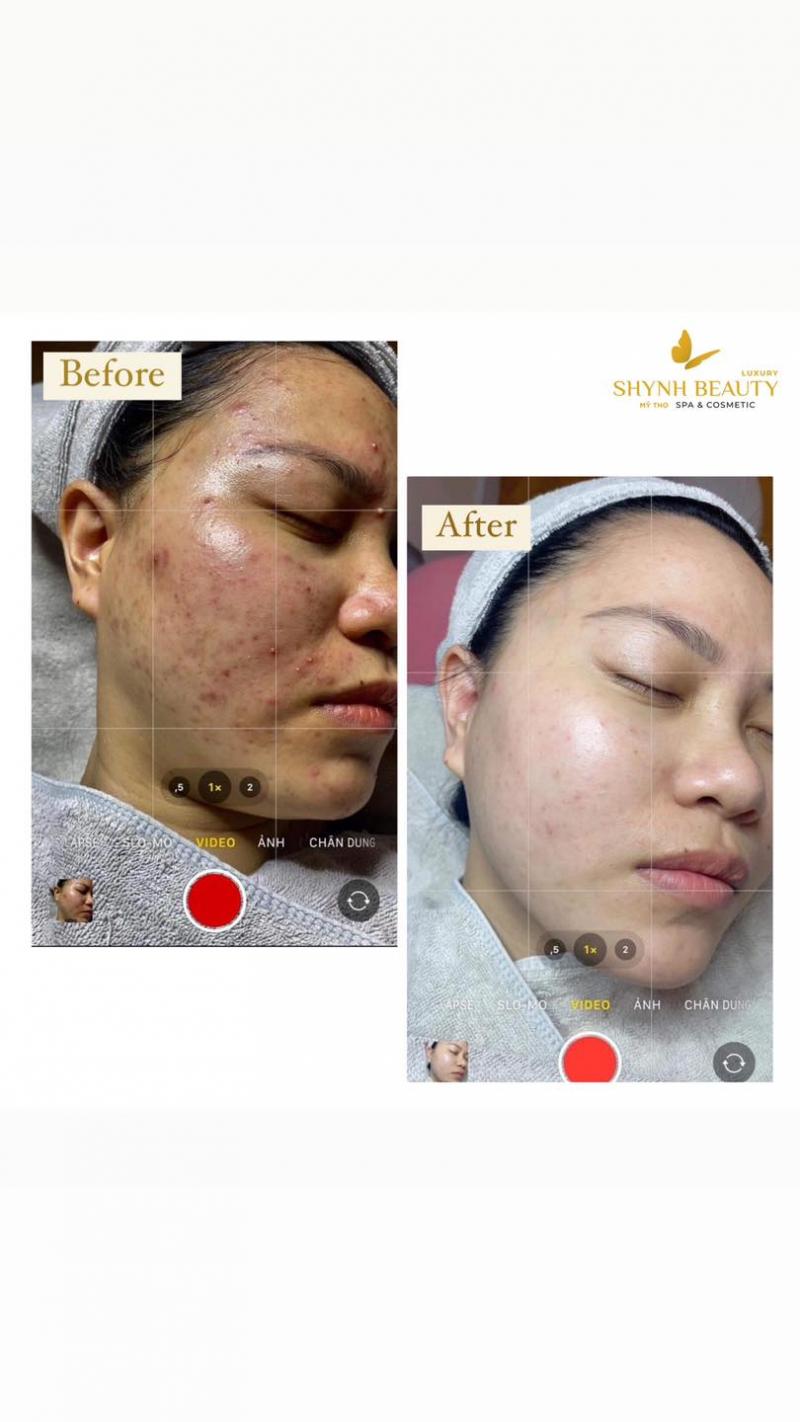 Shynh Beauty Spa