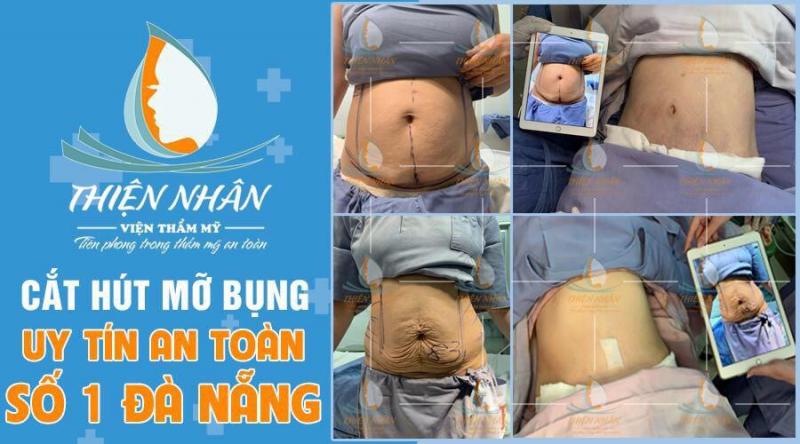 Skincare Thiện Nhân trang bị máy móc hiện đại