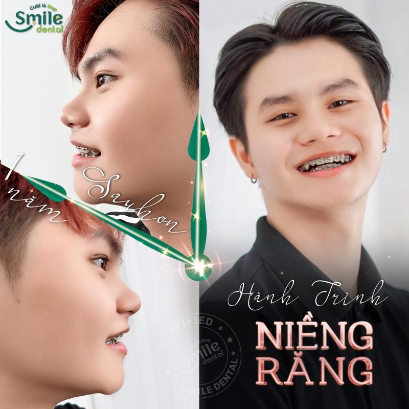 SMILE Bạc Liêu - Viện Nha Khoa Thẩm Mỹ Quốc Tế