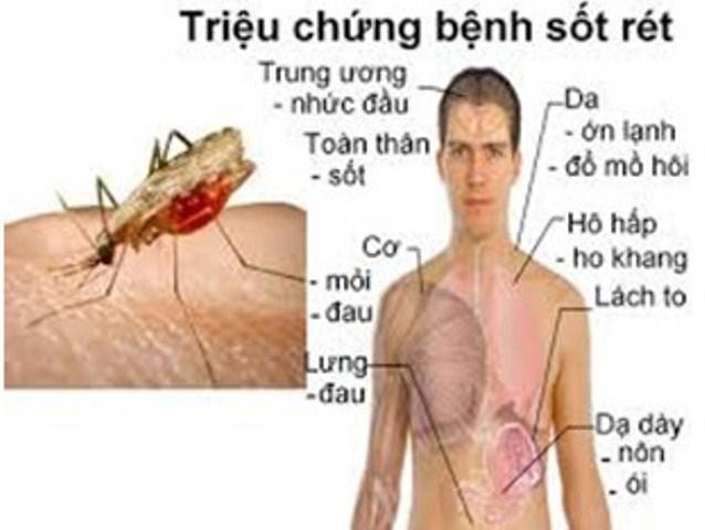 Sốt rét - Nguồn Internet