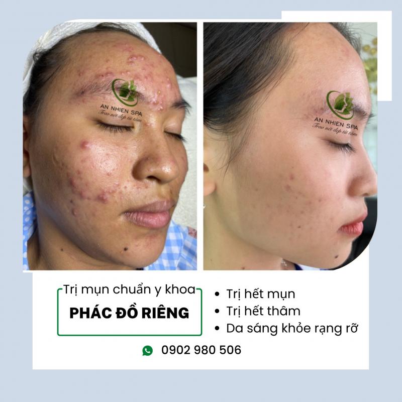 Spa An Nhiên-Bà Rịa