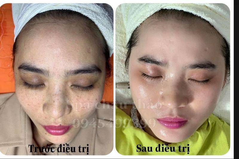 Spa Châu Thảo