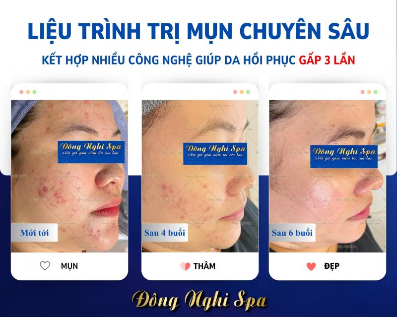 Spa Đông Nghi
