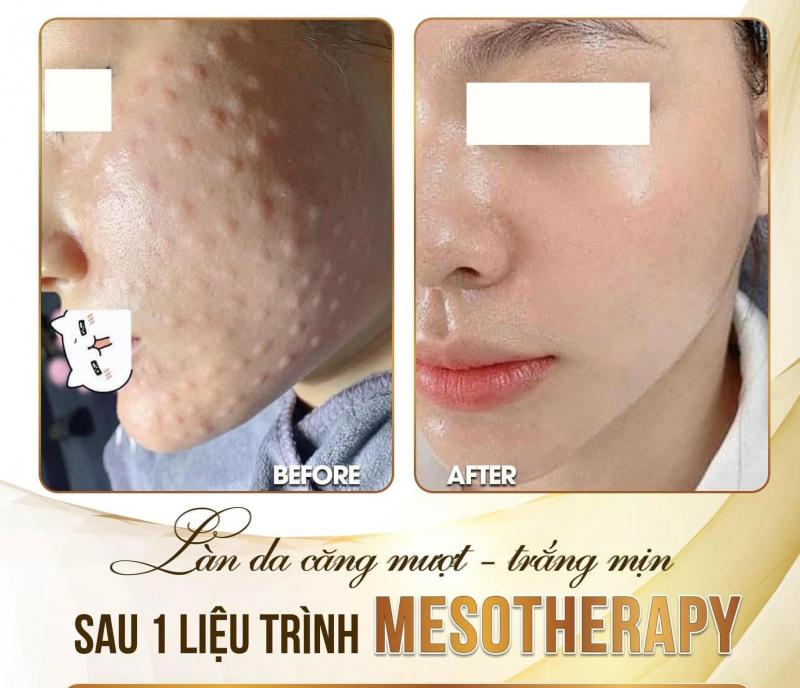 Spa Gia Linh