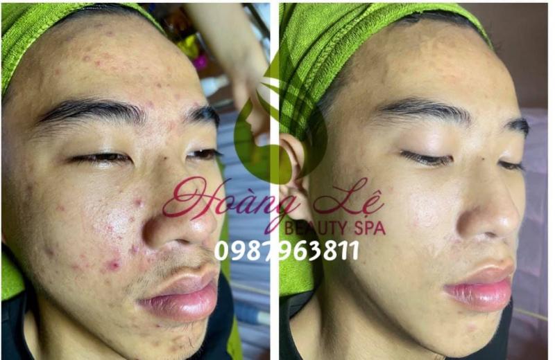 Spa Hoàng Lệ