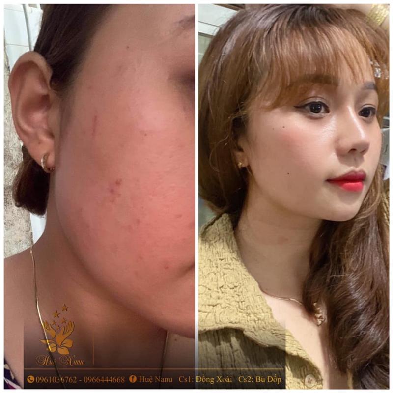 Spa Huệ Nanu