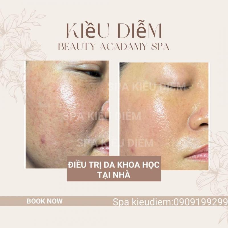 Spa Kiều Diễm