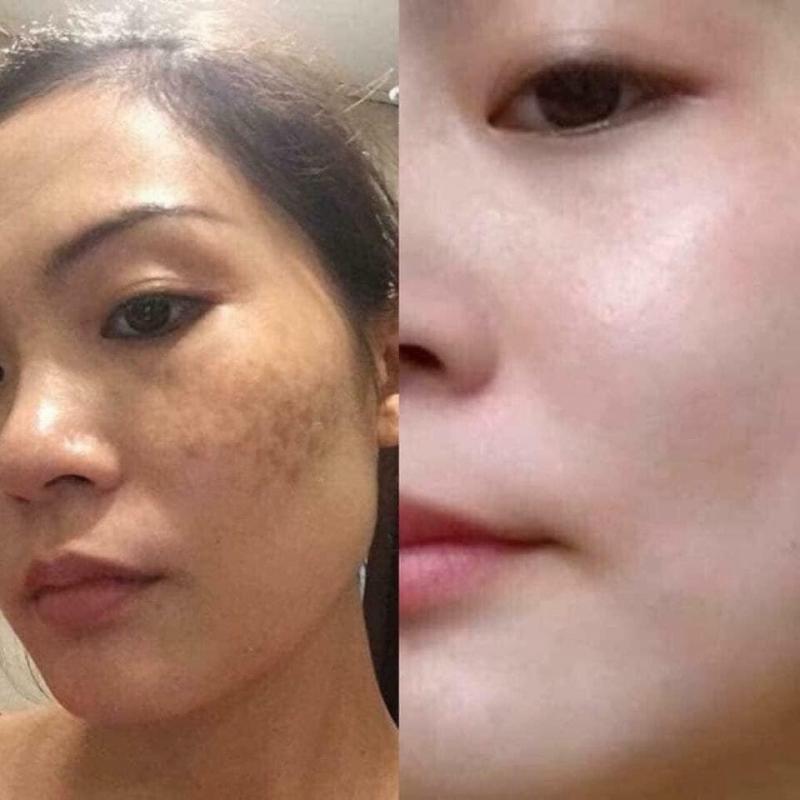 Spa Lee Ly