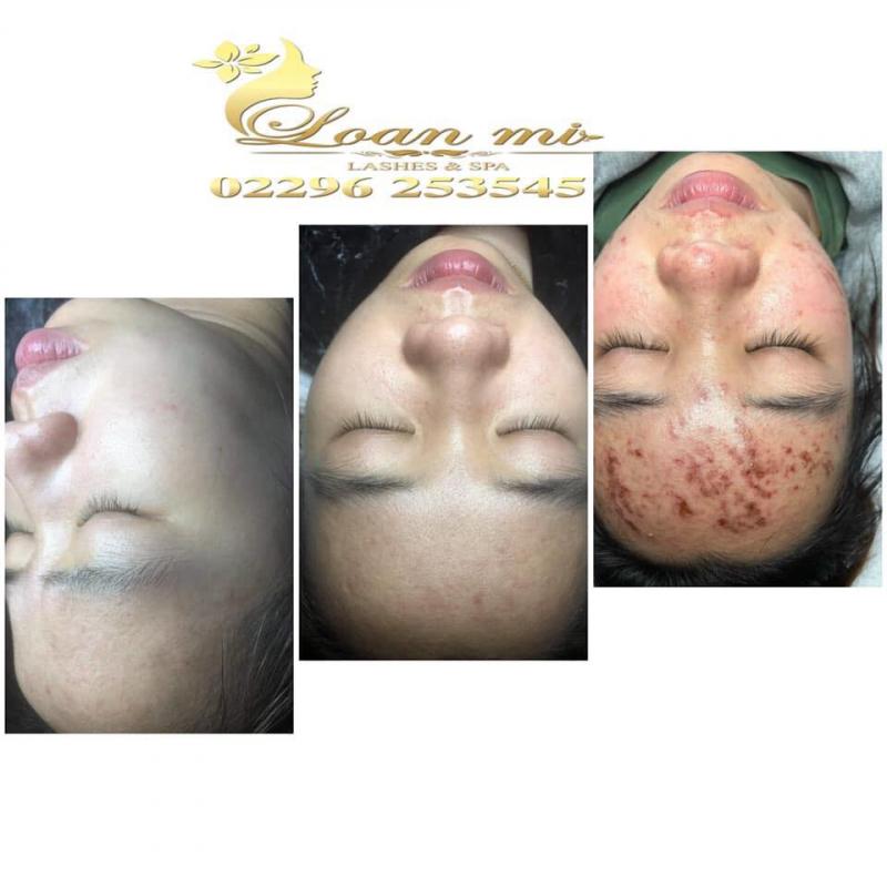 Spa Loan Mi