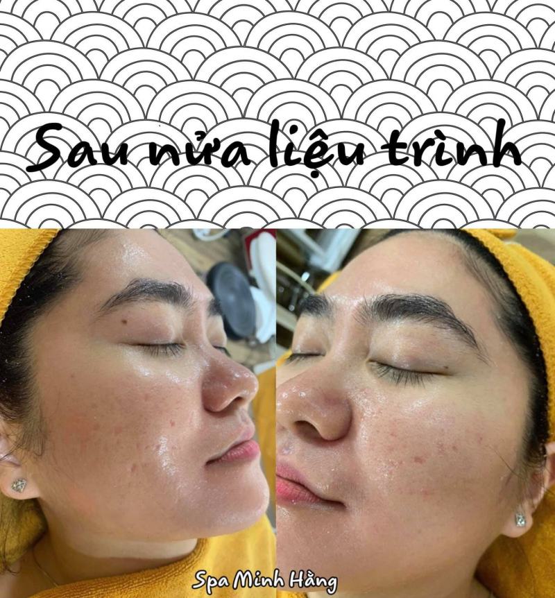 Spa Minh Hằng- Đại Lý phân phối Obagi Việt Nam